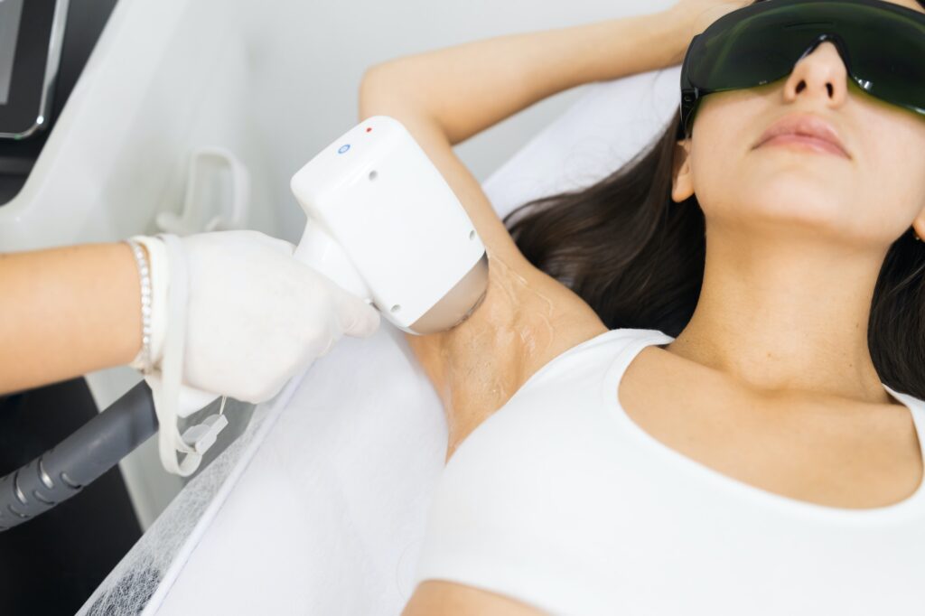 Understanding The Laser Hair Removal Process in Charleston, SC